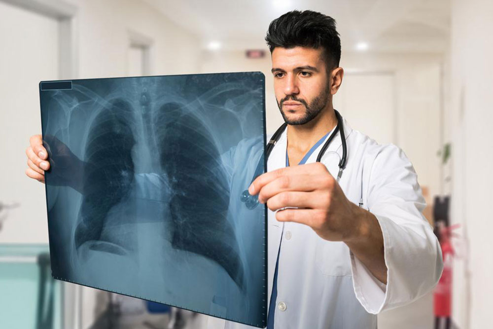 How to Safeguard Your Lungs Against Pulmonary Thromboembolism