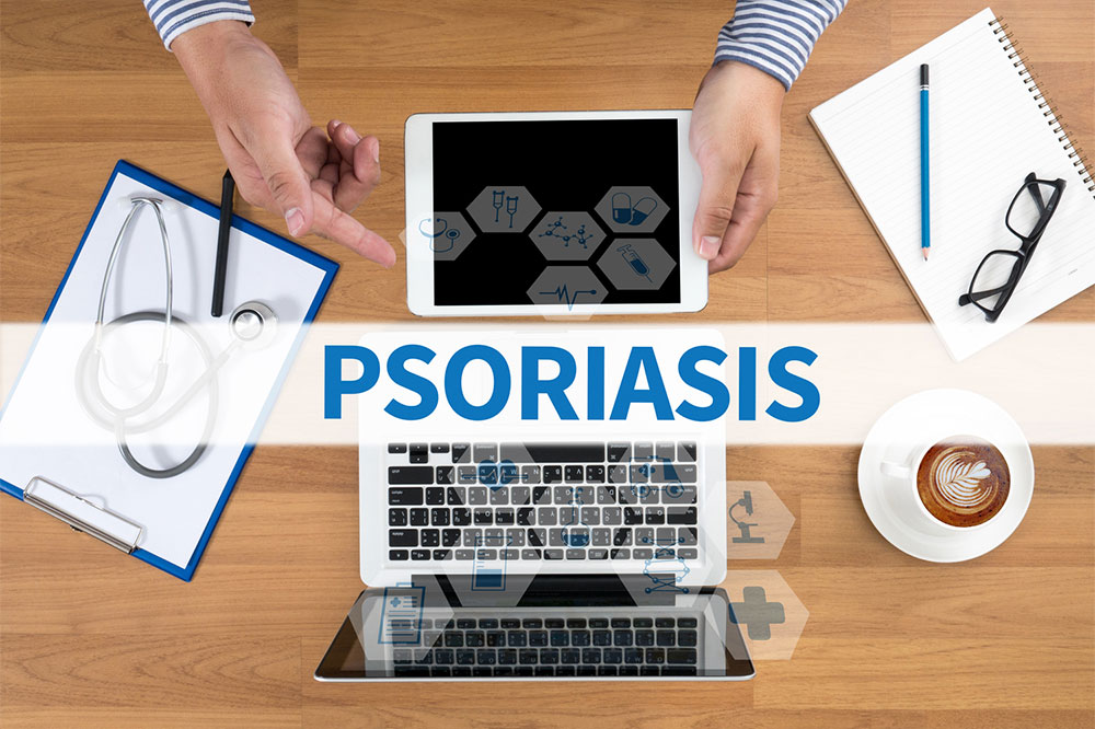 Comprehensive Guide to Psoriasis: Types, Symptoms, and Triggers