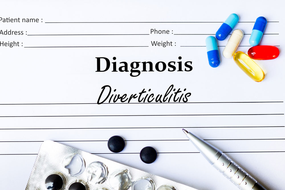 Essential Insights into Diverticulitis: Causes, Symptoms, and Treatment