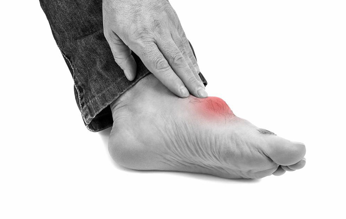 Comprehensive Guide to Effective Gout Management and Treatments
