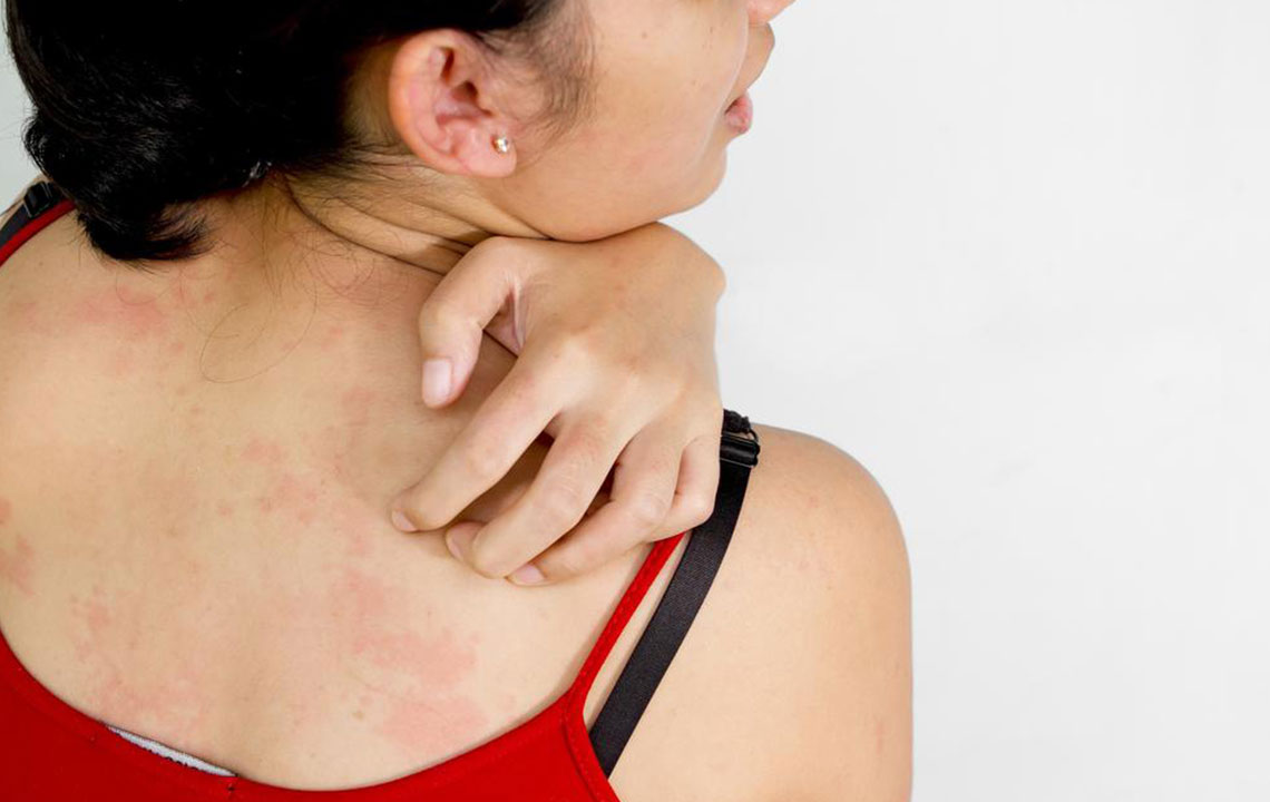 Effective Remedies for Yeast Infections