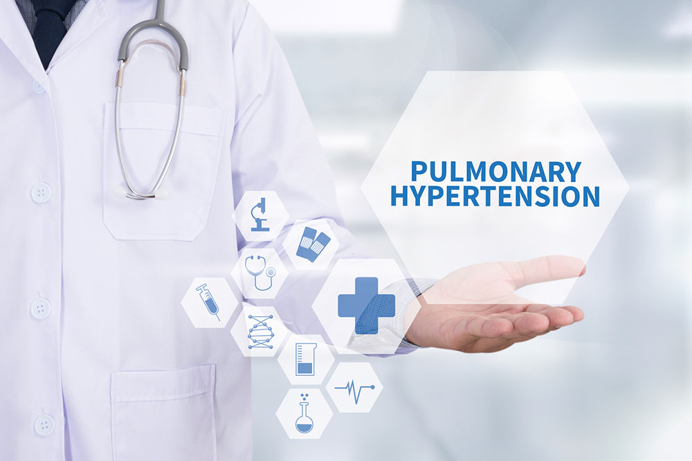 Understanding Pulmonary Hypertension: Causes, Symptoms, and Prevention