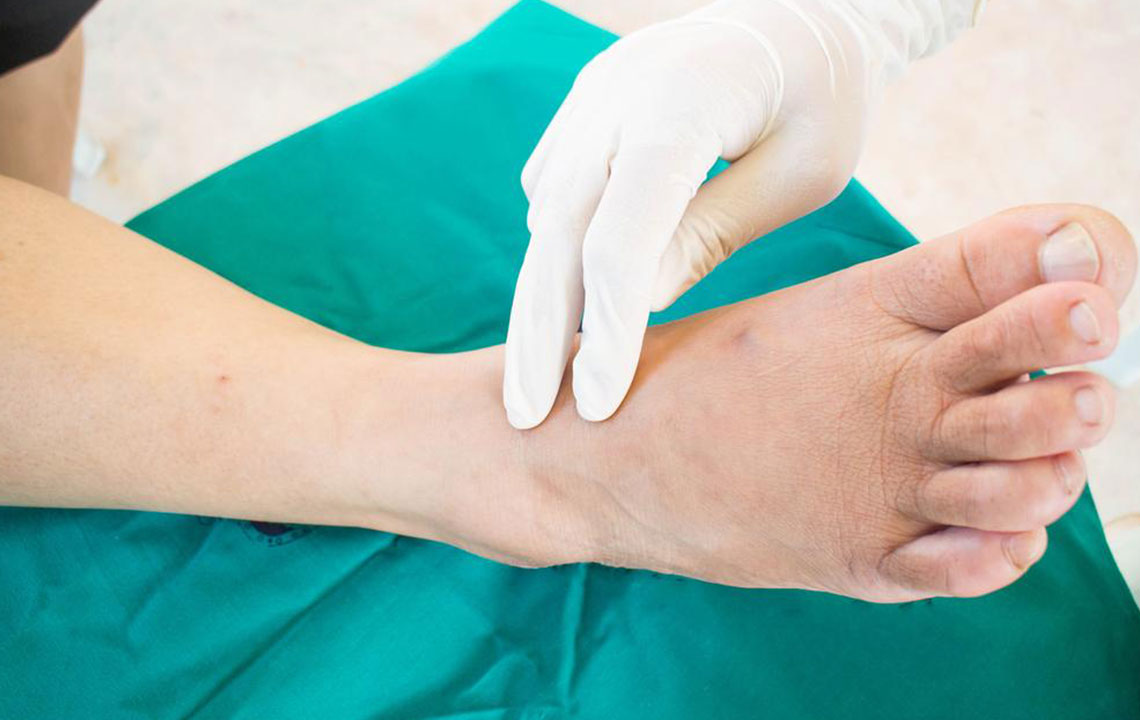 Comprehensive Guide to Neuropathy: Symptoms, Causes, and Types Explained in Detail