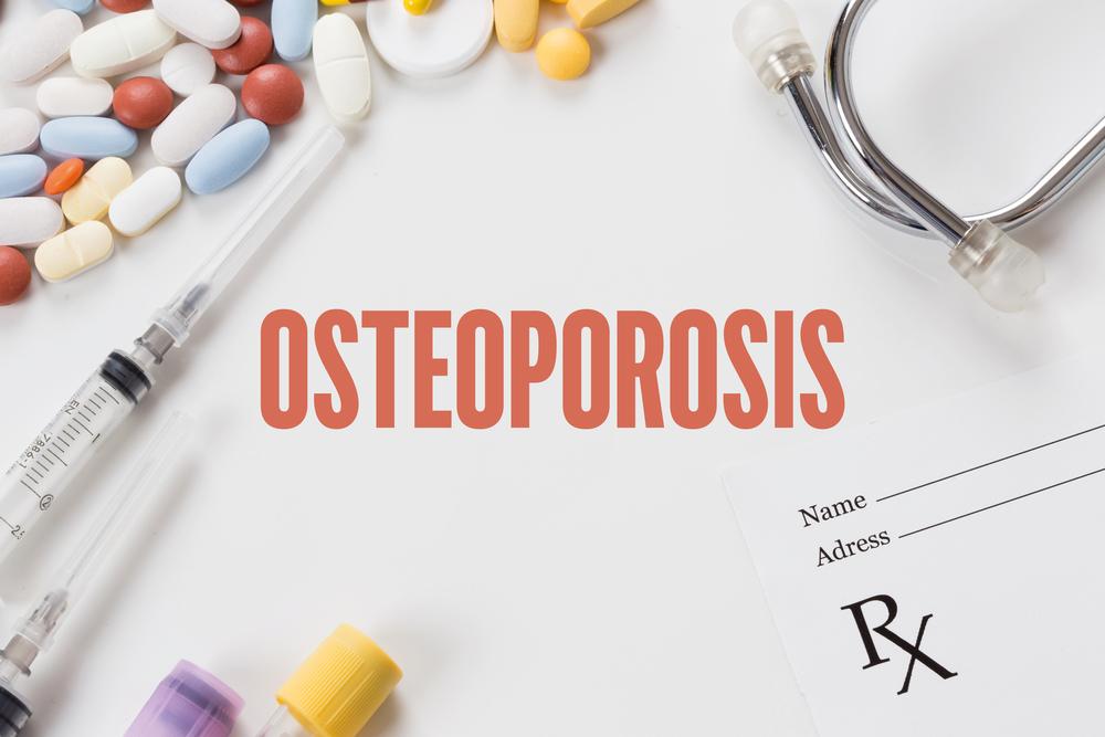 Understanding Osteoporosis: Causes, Risks, and Prevention