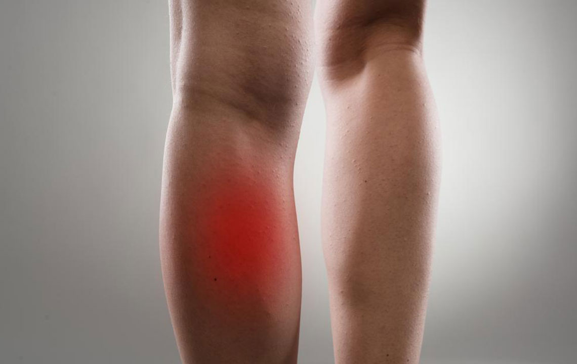 Understanding Leg Muscle Pain: Causes and Effective Remedies
