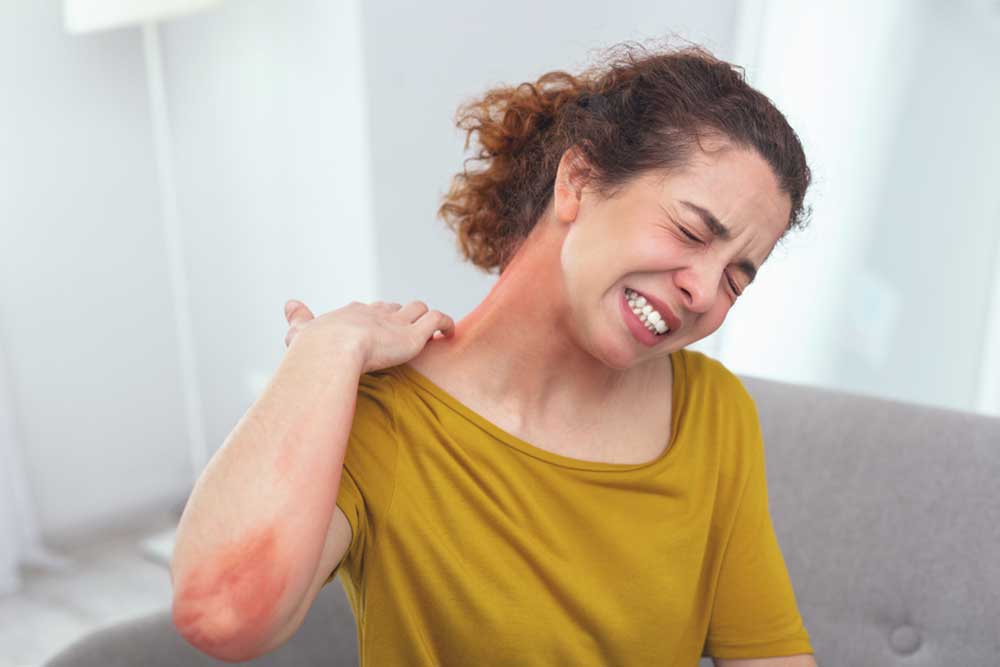 Comprehensive Guide to Shingles Rash Symptoms and Prevention