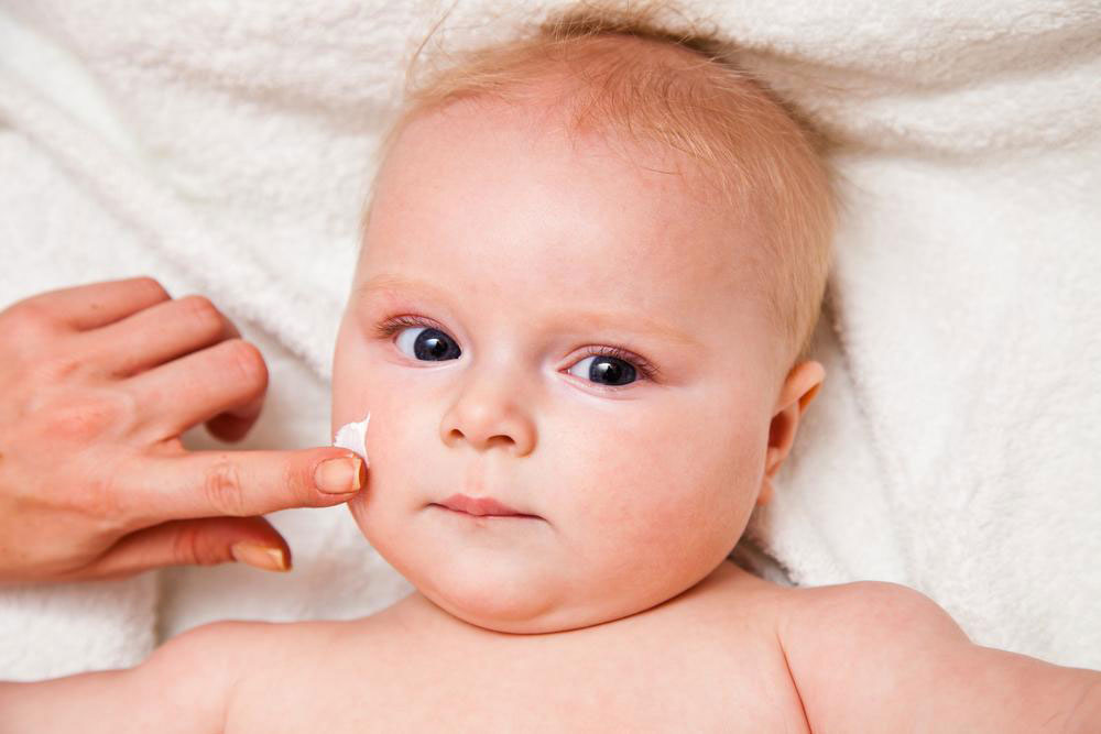 Understanding Infant Eczema: Symptoms, Causes, and Effective Treatments