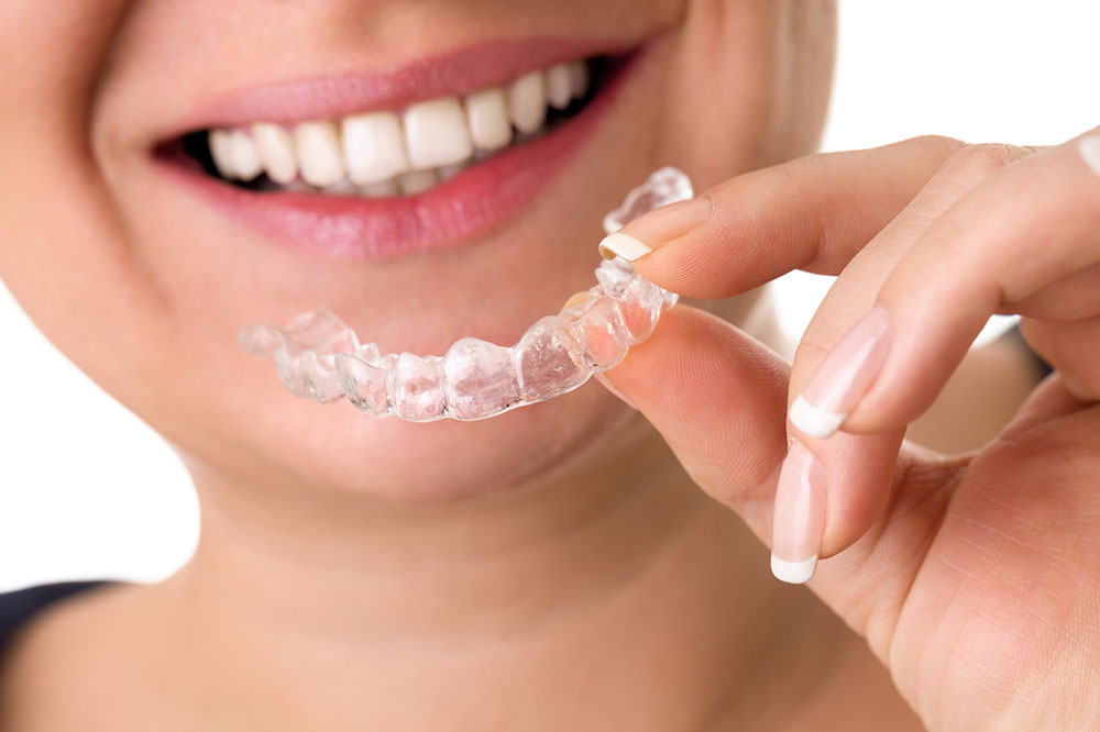 A Complete Guide to Clear Aligners for Teeth Correction