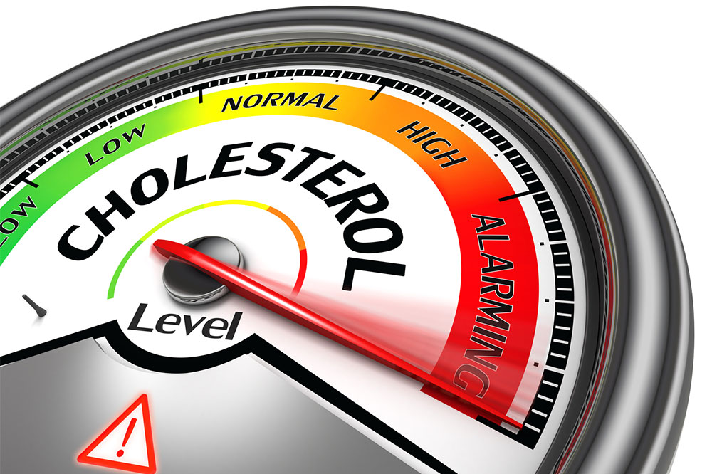 Understanding Cholesterol: Myths and Facts