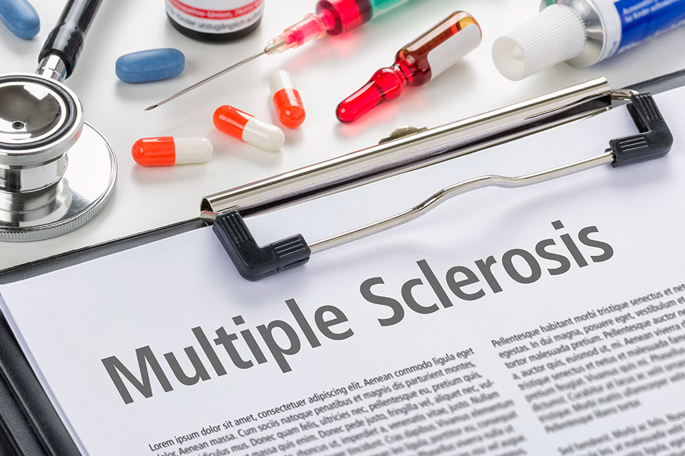 Understanding Multiple Sclerosis: Stages, Diagnosis, and Prevention Strategies