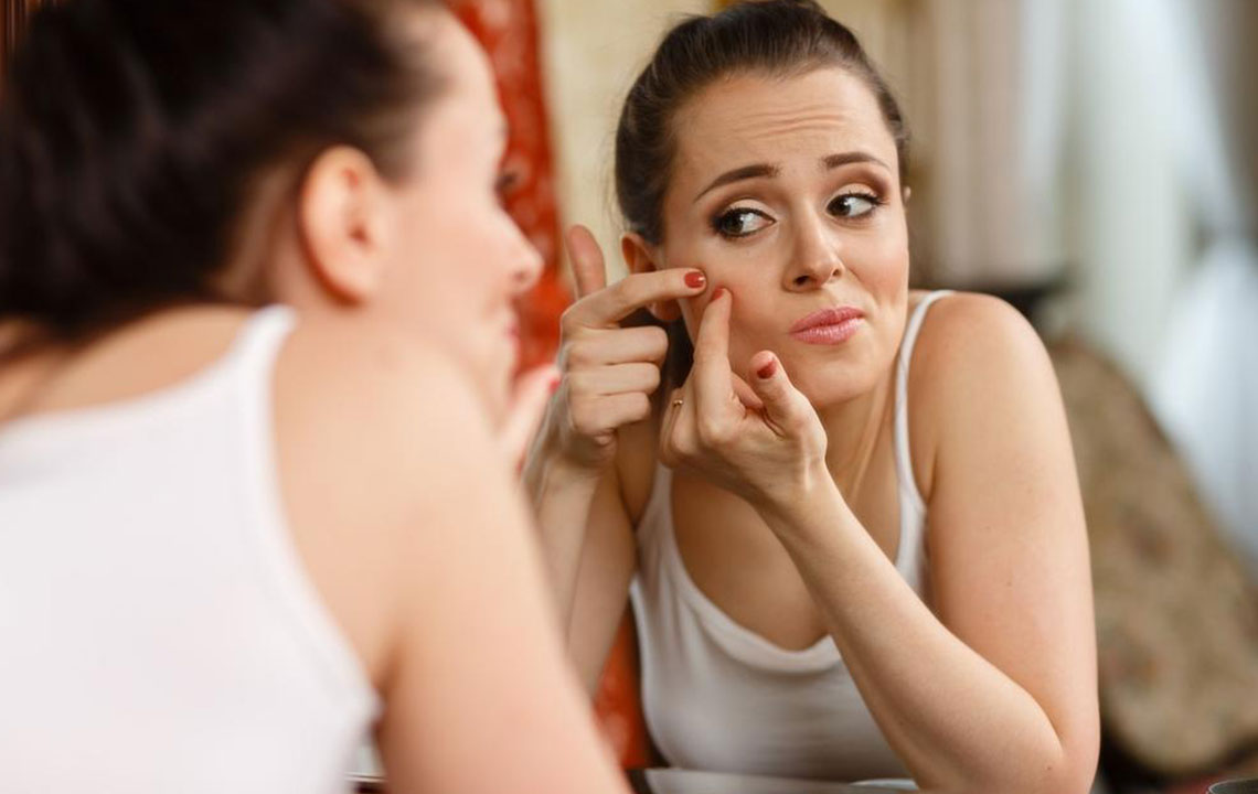 Essential Guide to Adult Acne Management and Treatments