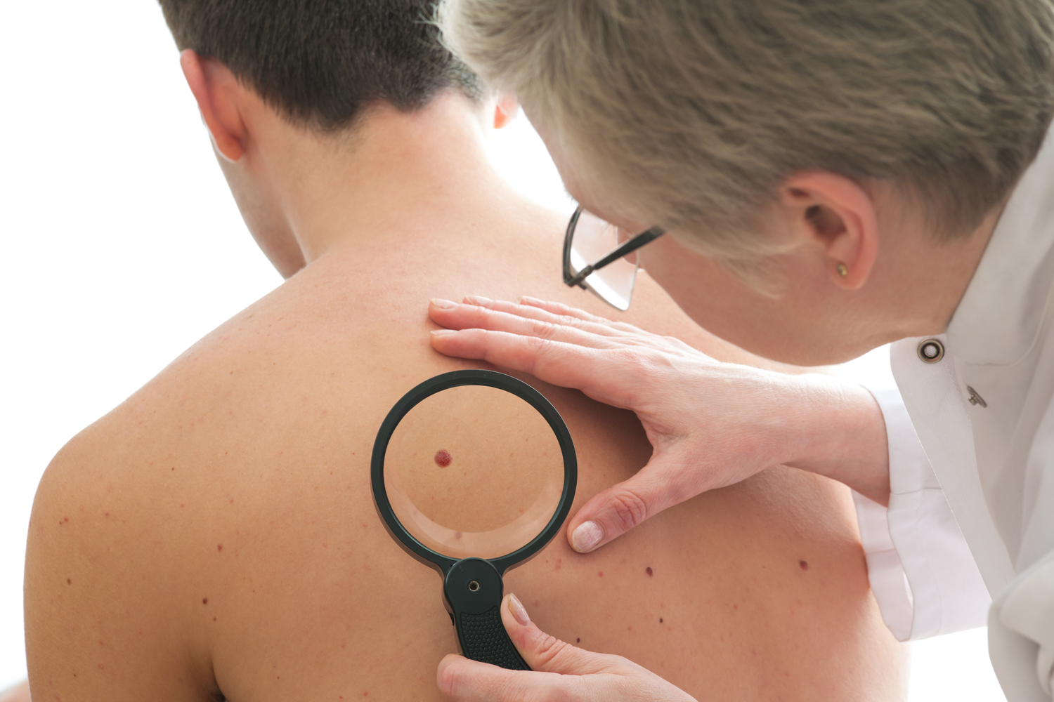 Comprehensive Guide to Cellulitis: Causes, Symptoms, Prevention, and Treatment Strategies