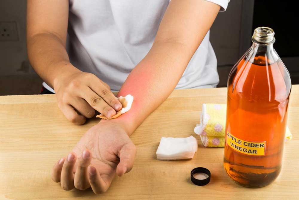 Simple Strategies for Rapid Bruise Recovery