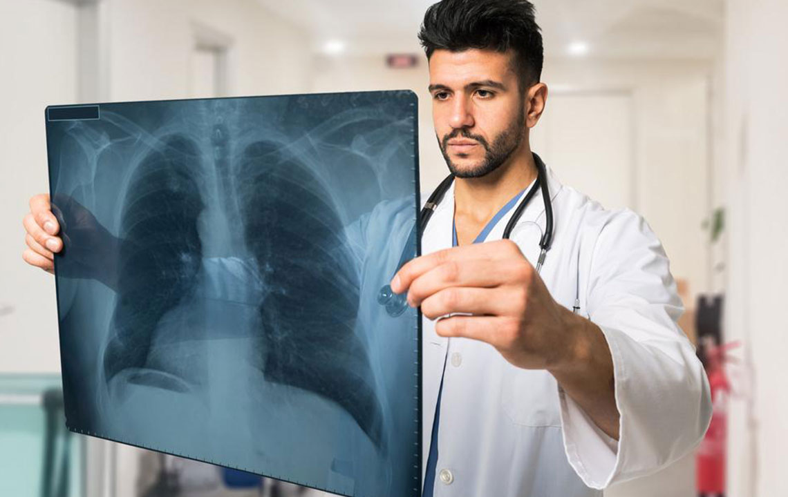 Key Insights into Immunotherapy for Lung Cancer Treatment