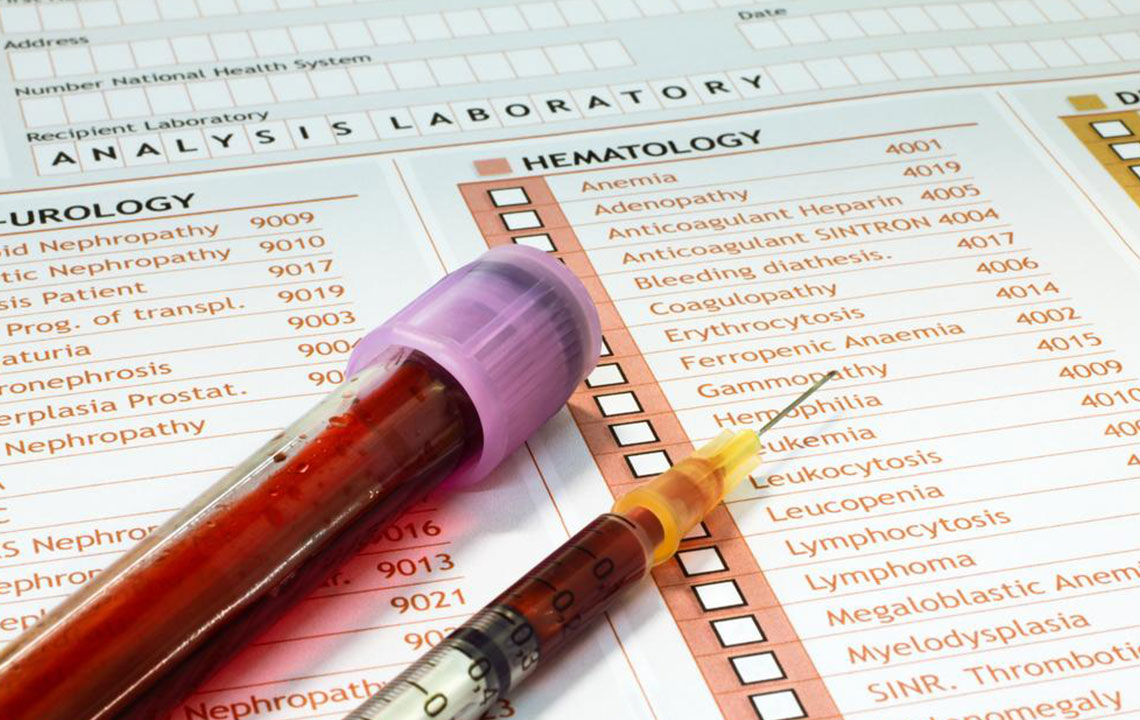 Understanding Premature Ejaculation: Causes and Treatment Options