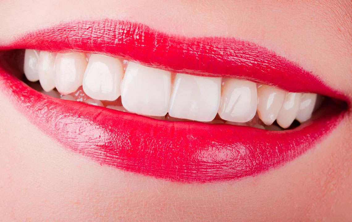 Top 4 Tips for Achieving Bright, White Teeth