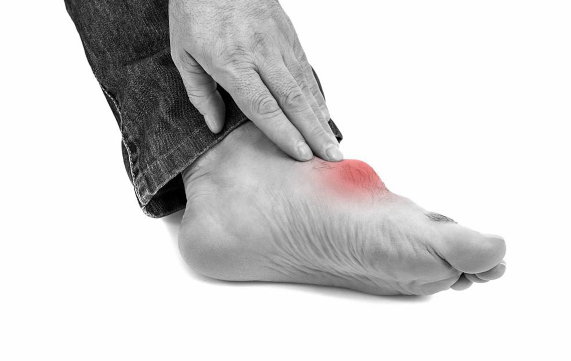 Major Factors That Trigger Gout Foot Discomfort