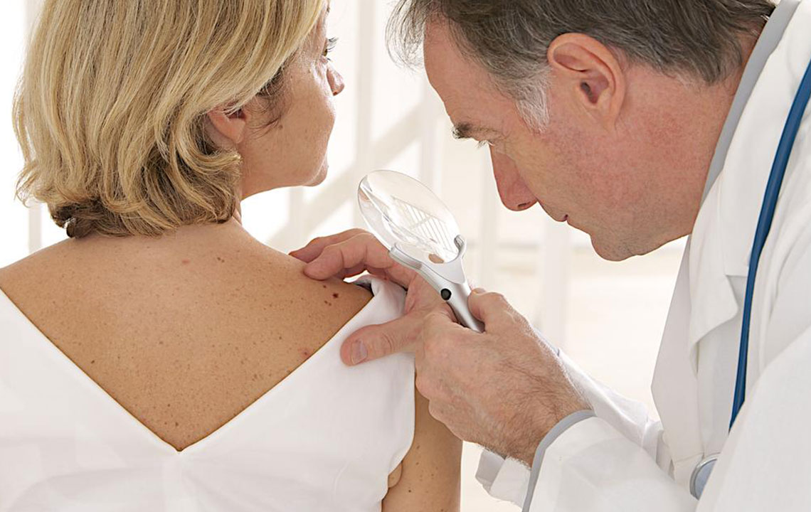 Top 4 Treatment Strategies for Patients with Myeloma