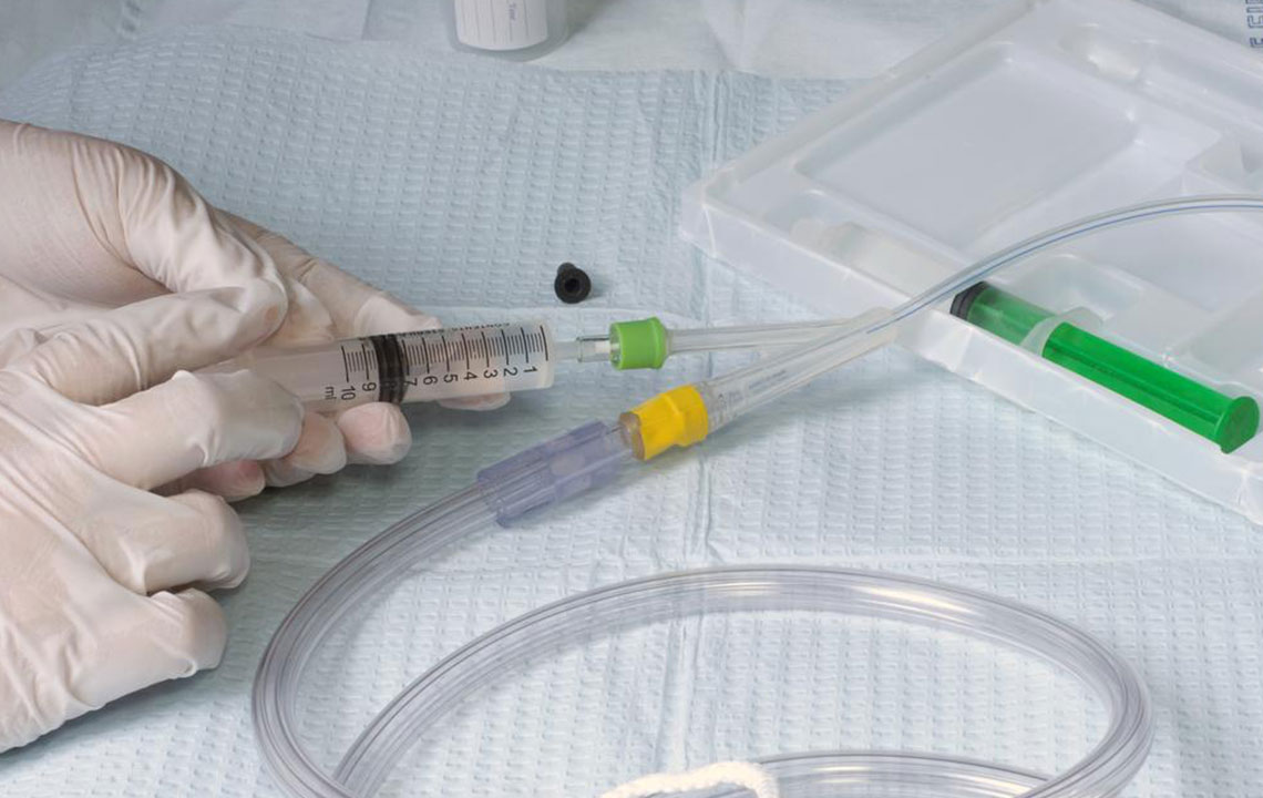 Comprehensive Approaches to Managing Bladder Leakage for Better Quality of Life