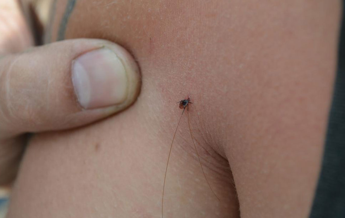 Comprehensive Guide to Identifying and Treating Spider Bites Effectively