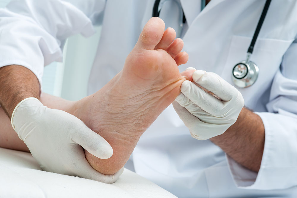 Top Remedies for Fungal Toenail Infections
