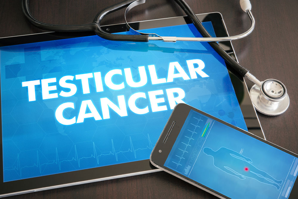Comprehensive Guide to Testicular Cancer: Symptoms, Causes, and Effective Treatment Strategies