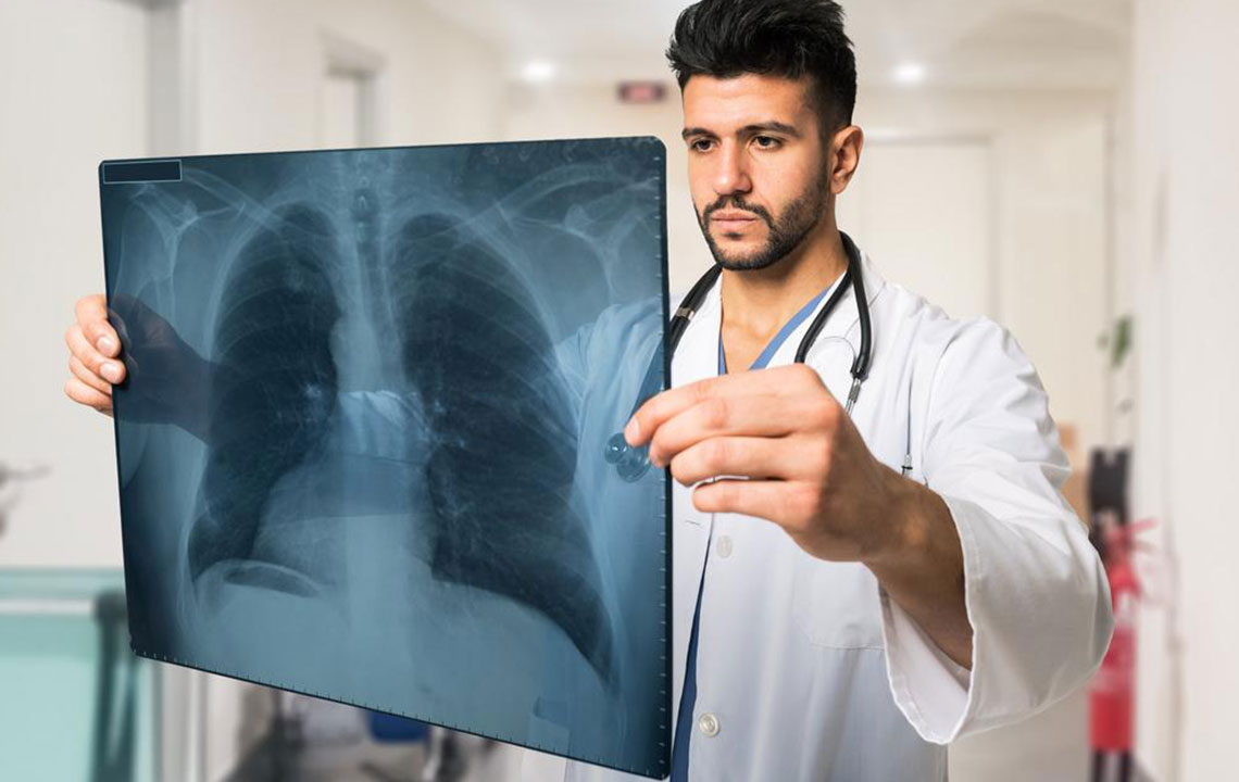 Comprehensive Overview of Pulmonary Fibrosis