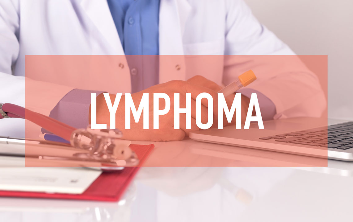 Understanding Lymphoma: Causes, Risks, and Symptoms