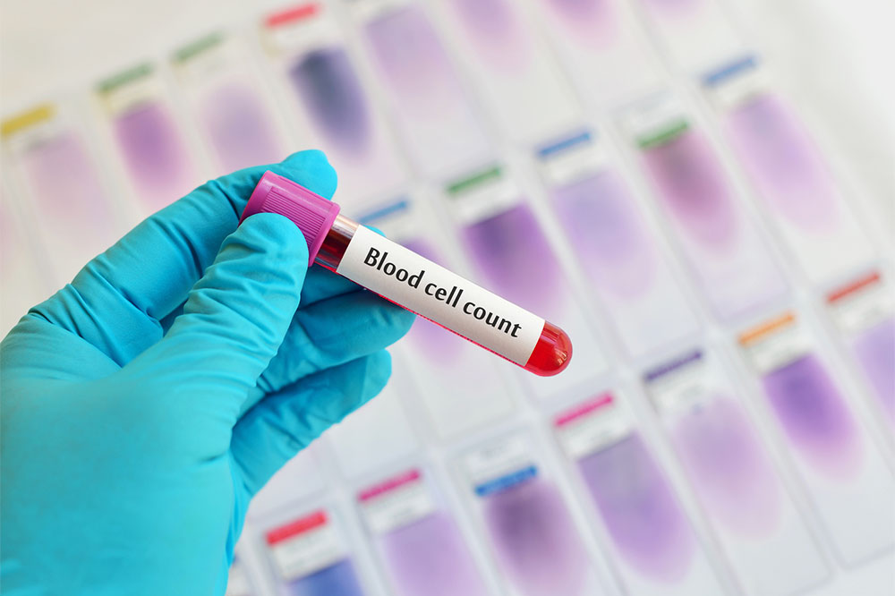 Blood Cell Levels and Health
