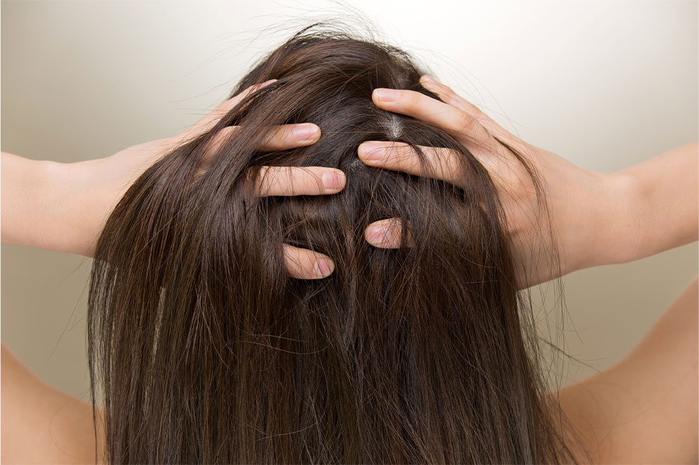 Top 5 Effective Solutions for Hair Loss Prevention