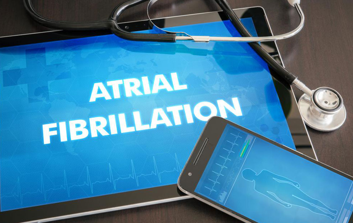 Effective Strategies for Managing Atrial Fibrillation and Protecting Your Heart