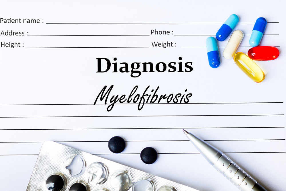 Understanding Myelofibrosis: Symptoms, Causes, and Treatment Strategies