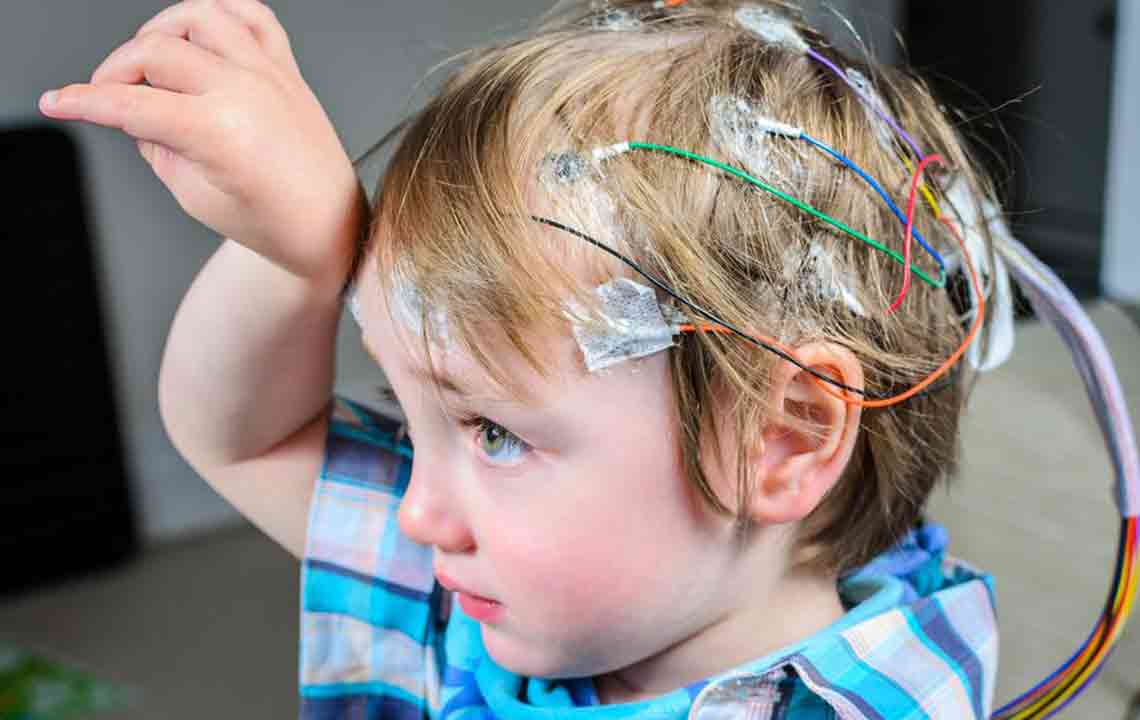 Essential Guidelines for Managing Seizures Effectively