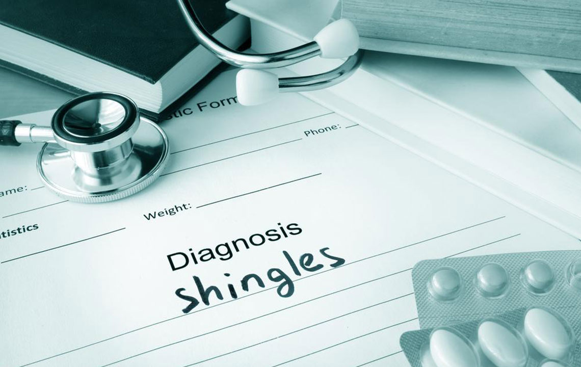 Holistic Approaches to Managing Shingles