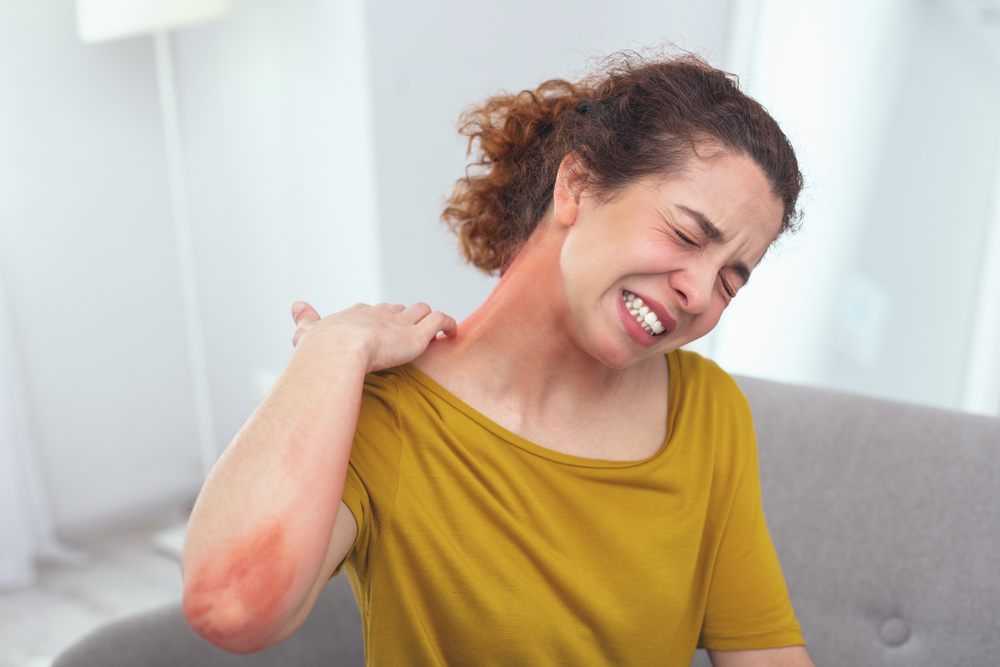 Comprehensive Guide to Managing Atopic Dermatitis: Effective Strategies and Treatments