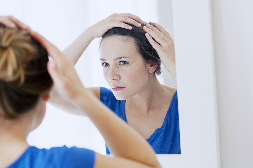 Medical Conditions Causing Significant Hair Loss
