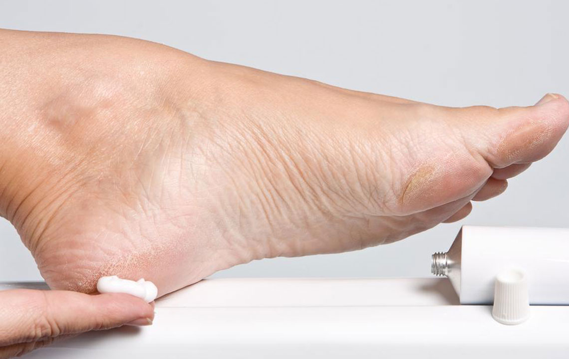 Effective Strategies to Relieve Foot Nerve Discomfort
