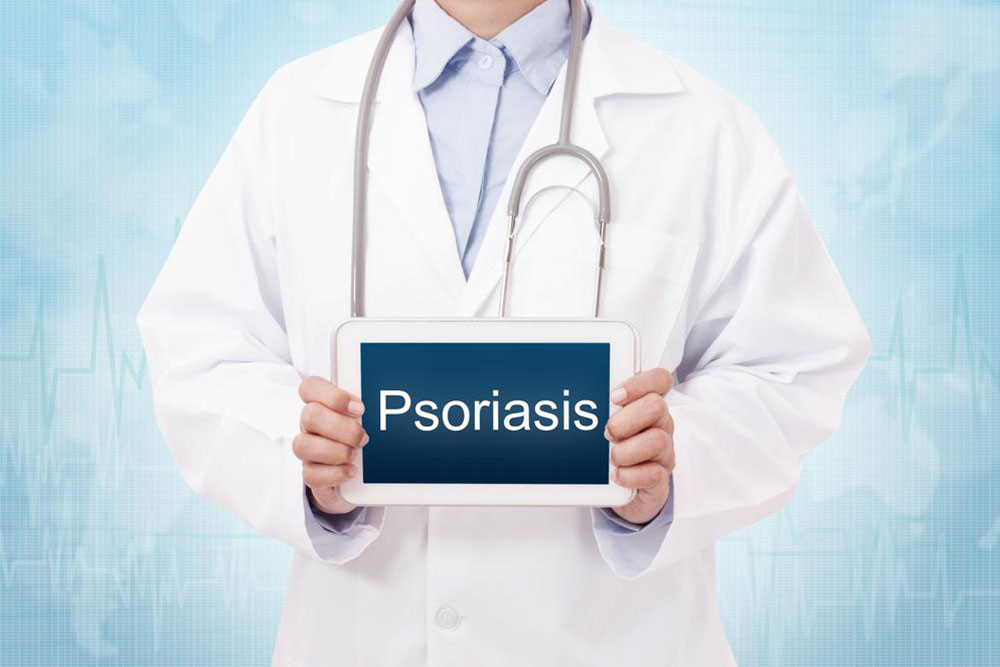 Effective Strategies for Managing Plaque Psoriasis