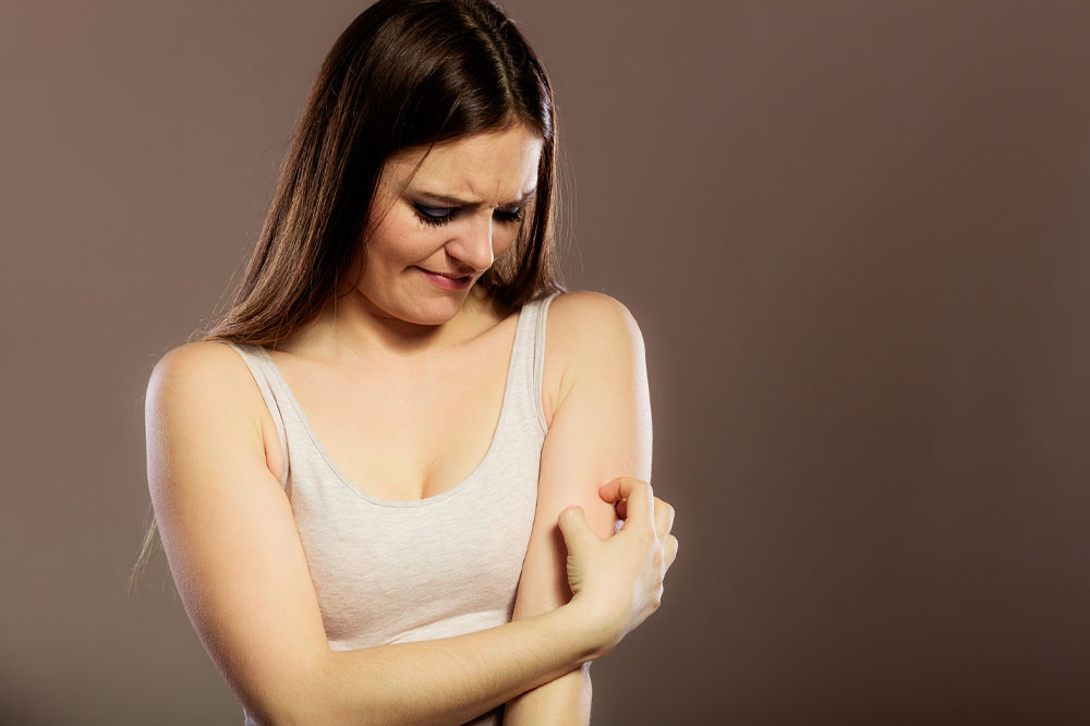 How to Recognize and Manage Bed Bug Bites Effectively