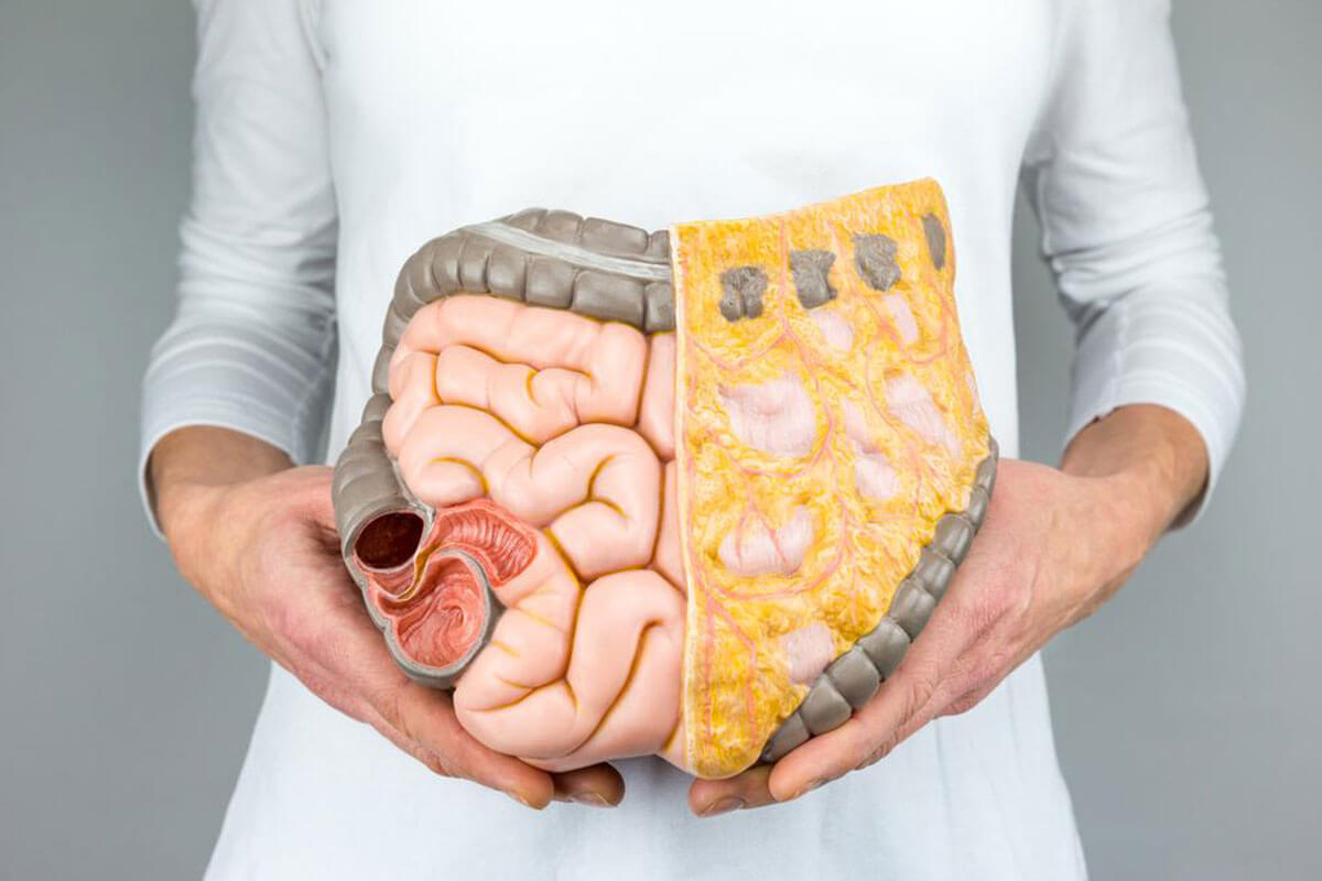 Dietary Strategies to Alleviate Gastric Cancer Symptoms