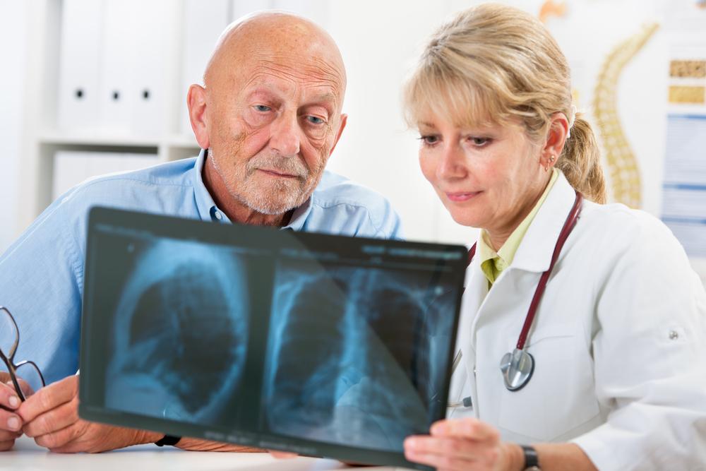 Understanding Metastatic Lung Cancer: Stages and Treatment Options