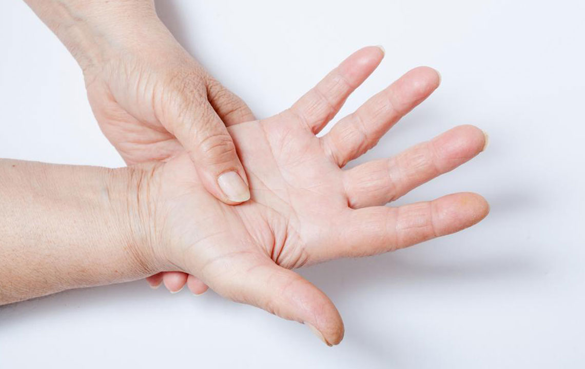 Recognizing the 8 Key Signs of Lupus