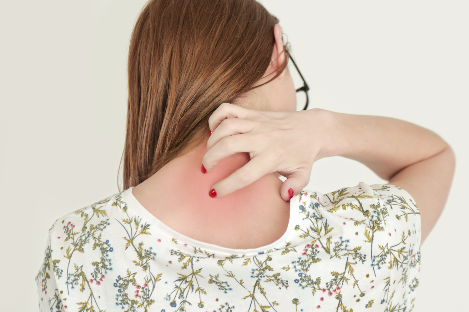 Comprehensive Guide to Preventing and Managing Shingles Effectively