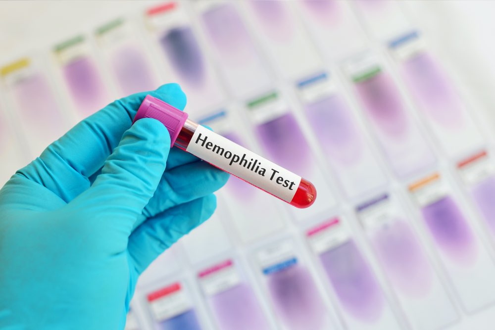 Comprehensive Guide to Nutrition: Top 4 Foods to Support Hemophilia Management and Improve Quality of Life