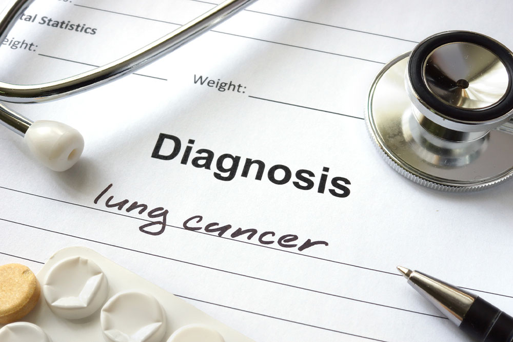 Comprehensive Guide to Lung Cancer: Types, Causes, Symptoms, and Prevention Strategies