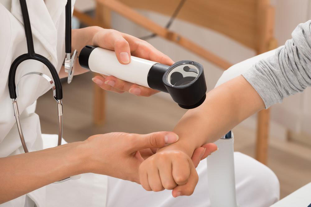 Effective Treatment Options for Psoriasis with Stelara