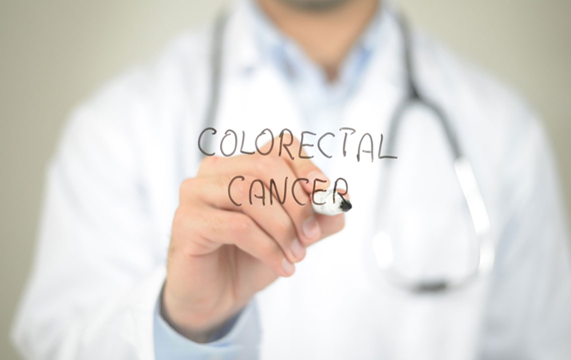 Understanding Causes and Detection Methods for Colorectal Cancer