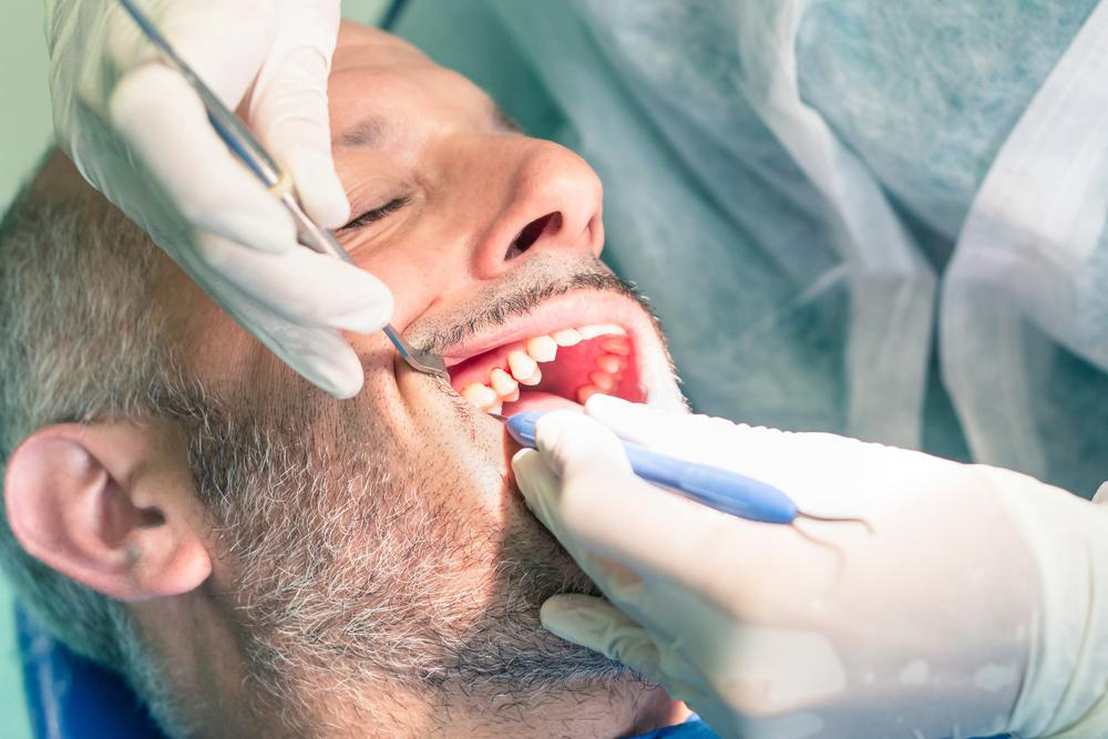 Effective Strategies for Preventing and Eliminating Dental Plaque