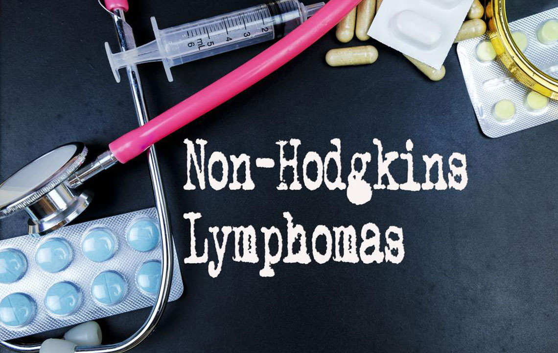 Top 6 Risk Factors Associated with Non-Hodgkin Lymphoma