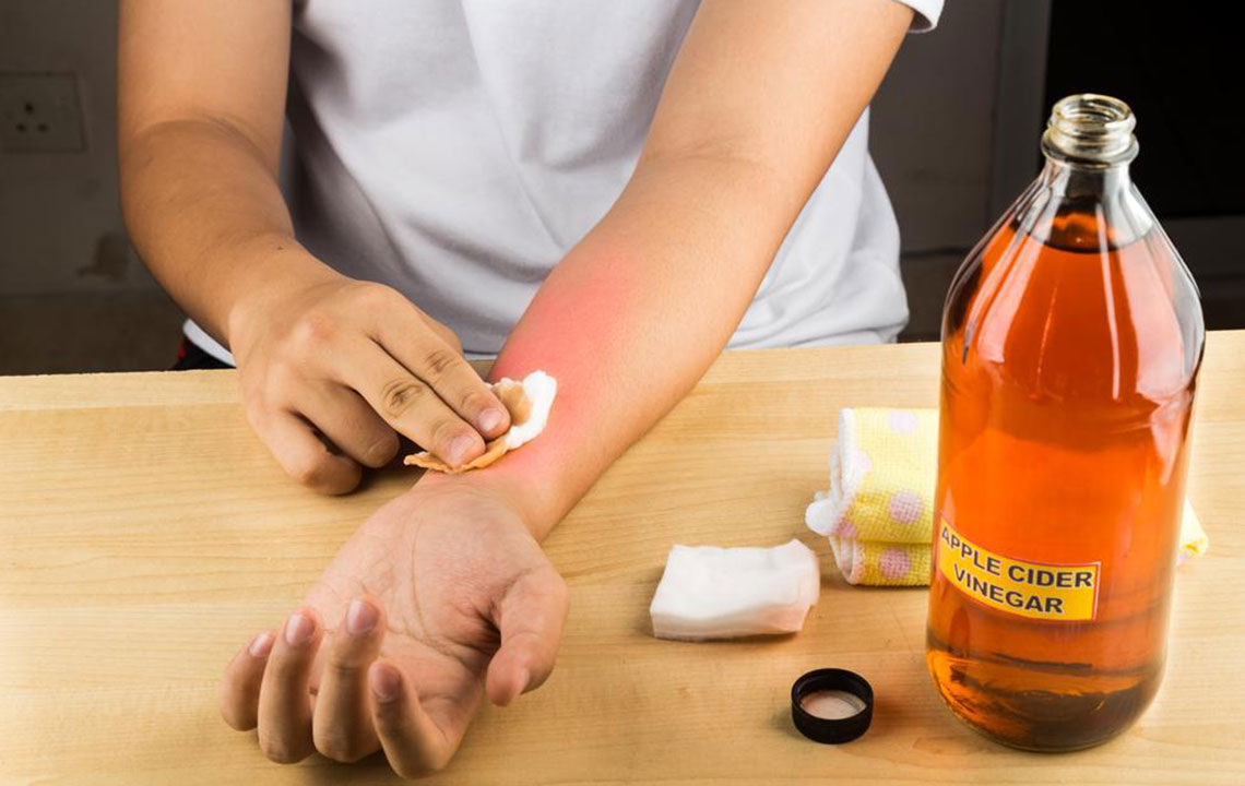 Effective Strategies to Alleviate Itchy Skin Discomfort